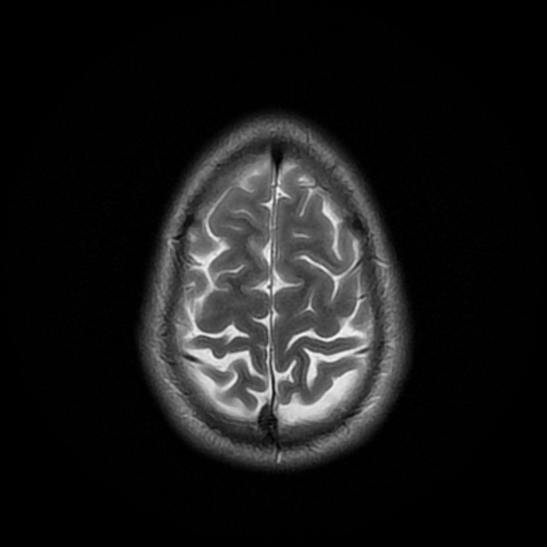DICOM Viewer Seçerken Dikkat Edilmesi Gereken 10 Kriter